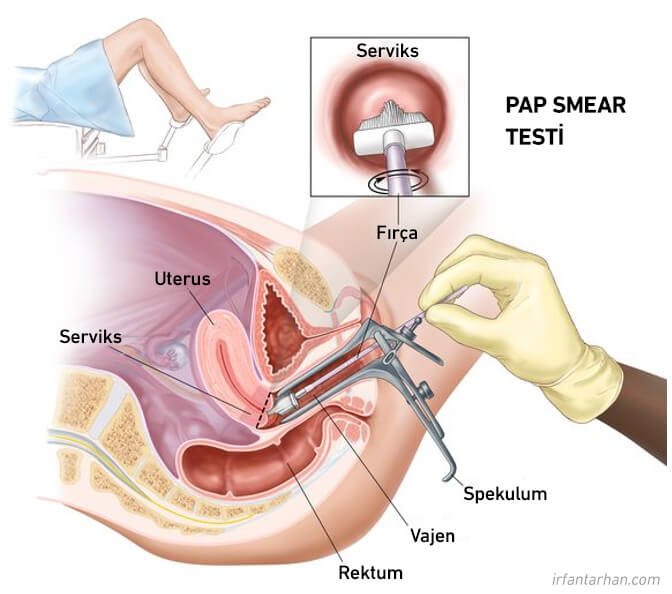 pap smear testi