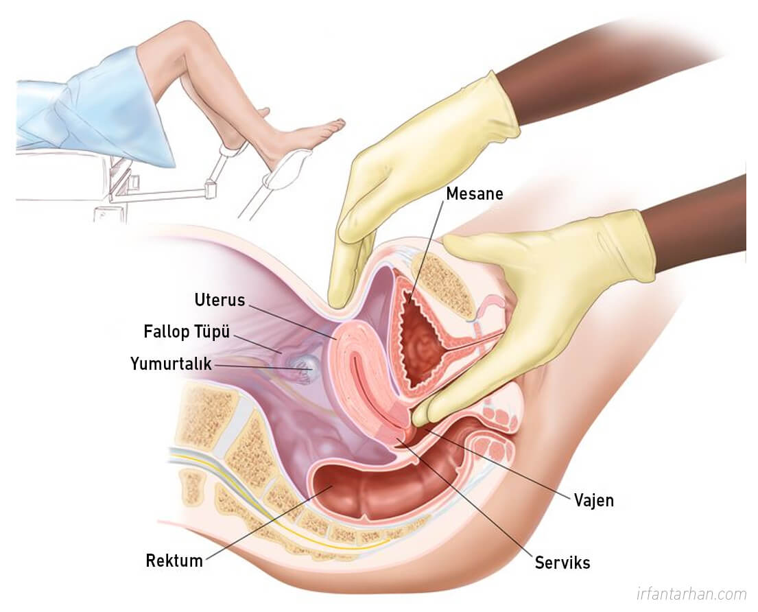 Rahim (Endometrium) Kanseri